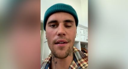 Justin Bieber revela padecer síndrome de Ramsay Hunt