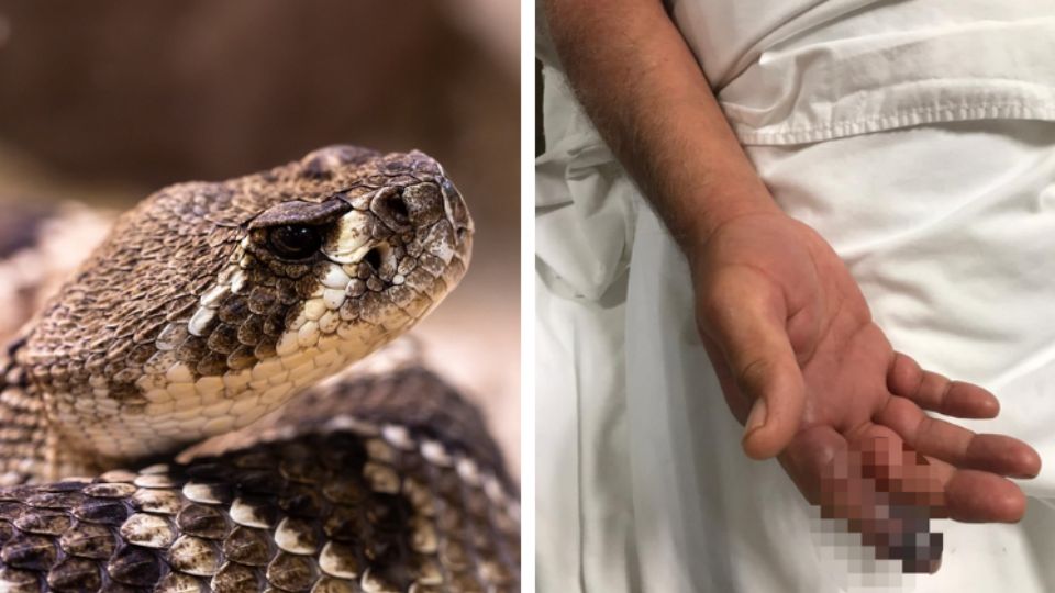 La mordedura de una serpiente de cascabel puede ser mortal si no se trata con un especialista. Foto: Pixabay / Facebook