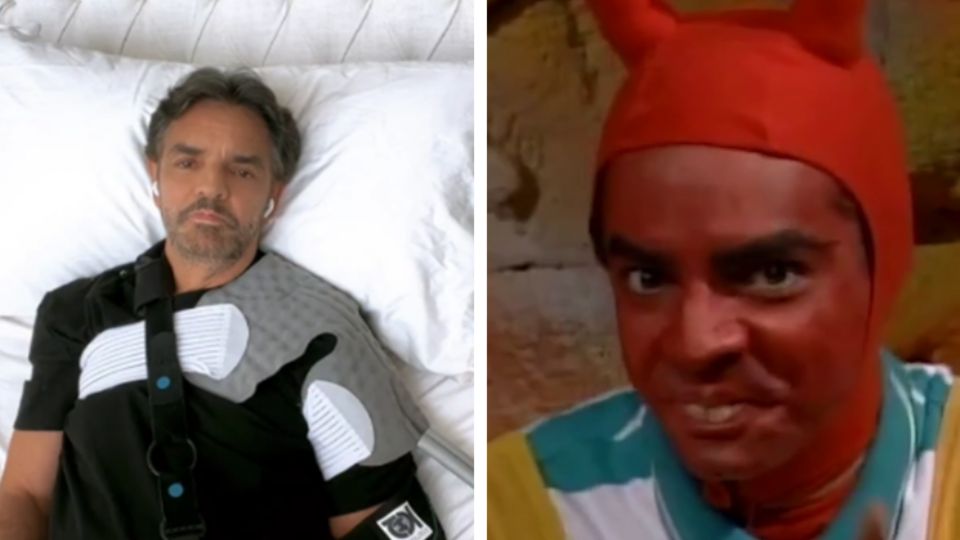 Eugenio Derbez toma con humor su caída y accidente en el hombro.