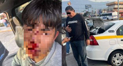 Acusan a taxistas de golpear a joven por un estacionamiento en Saltillo