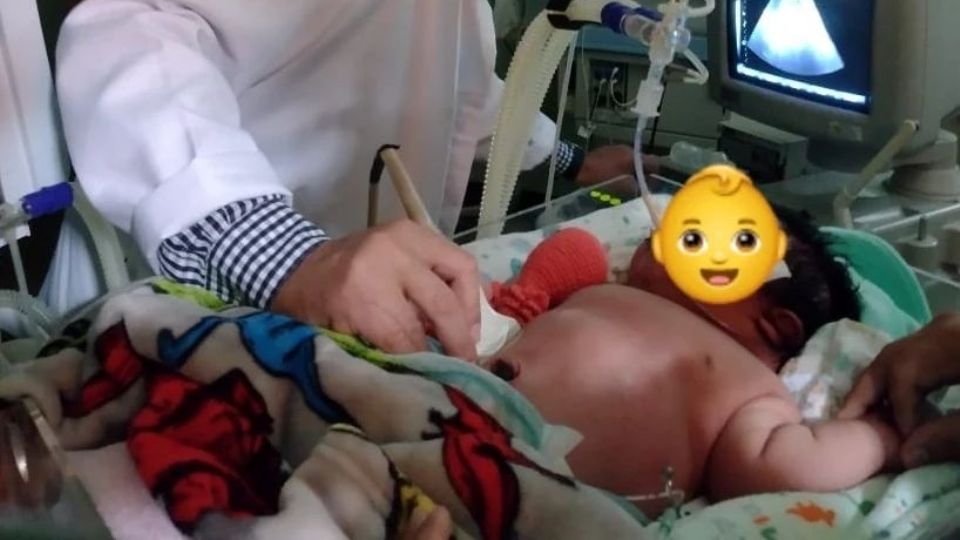 'Bebé Gigante' nace en Brasil | Facebook / Hospital Padre Colombo.