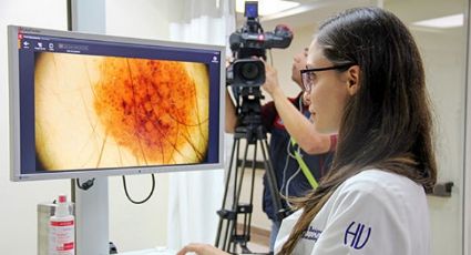 UANL realizará campaña para la detección y prevención de cáncer de piel en NL