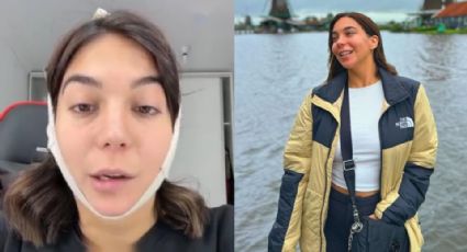 Influencer sufre parálisis facial tras someterse a una liposucción de papada