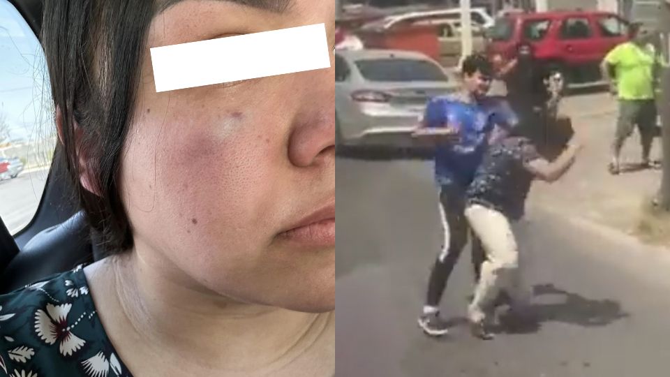 Joven explica pelea en calles de Escobedo y señala buscar a su agresor