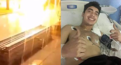 ‘Se me apagó la luz’, joven impactado por un rayo sobrevive en Argentina