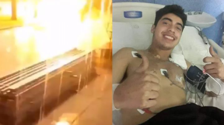 ‘Se me apagó la luz’, joven impactado por un rayo sobrevive en Argentina