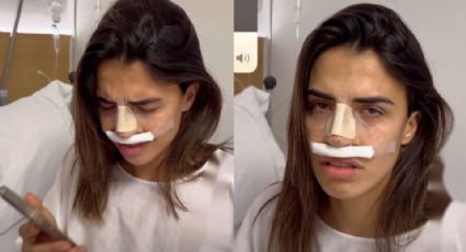 Video: Influencer rompe en llanto tras ver los resultados de su rinoplastia   