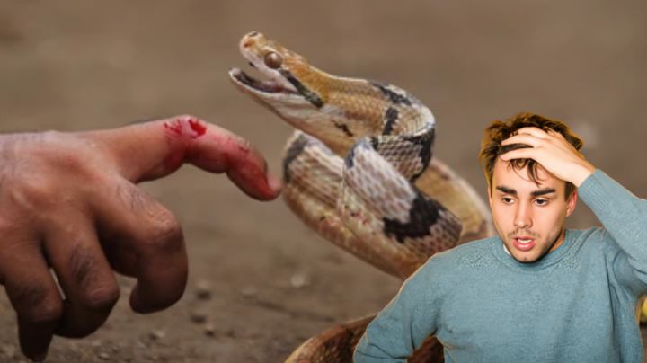 ¿Cuáles son los primeros auxilios ante una mordedura de serpiente? | Consejos clave