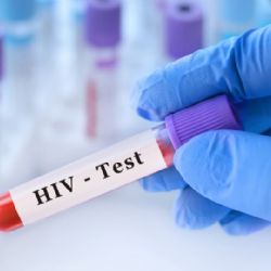 Indemnizan con 146 mil euros a italiana que contrajo VIH en laboratorio universitario