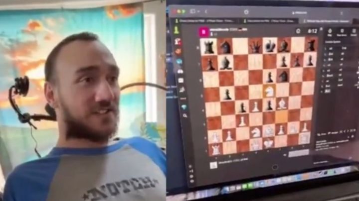 Revelan video de hombre con chip cerebral de Elon Musk