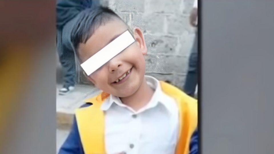 Niño pierde un ojo tras ser agredido por un compañero en una escuela de Hidalgo.