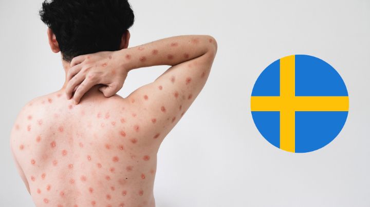 Brote de viruela del mono cruza fronteras e infecta a persona en Suecia