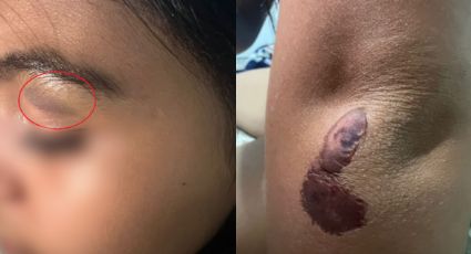 Madre denuncia injusticia hacia su hija golpeada y suspendida de la Preparatoria 16