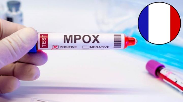 Detectan primer contagio de mpox 1b en Francia