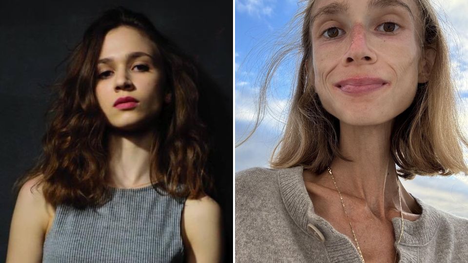 Karolina Krzyzak, joven fallecida por desnutrición | Facebook / Karolina Krzyzak