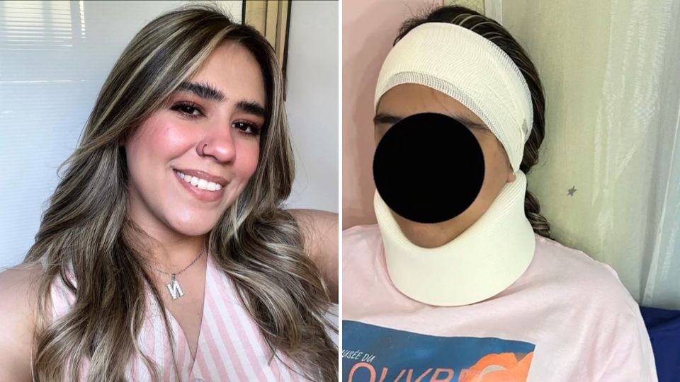 Joven es agredida mientras caminaba rumbo a su trabajo en Ciénega de Flores