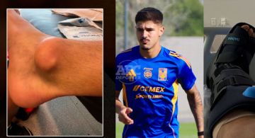 Rómulo Zwarg es operado del tobillo será baja entre cuatro y seis semanas