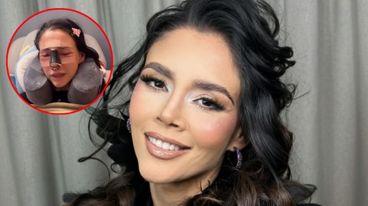 ¿Quién es Dorismar y qué le paso en el rostro?