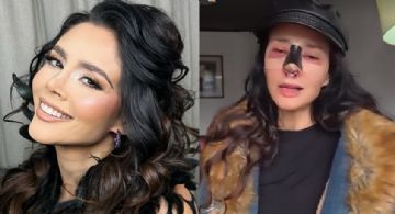 Abogado de Dorismar confirma amputación parcial de la nariz y daños irreversibles