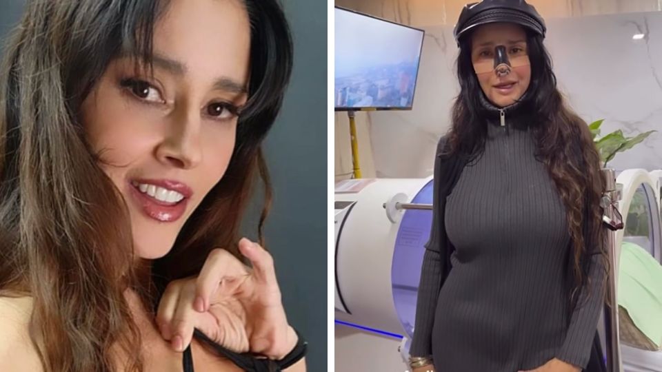 Dorismar compartió en su cuenta de Instagram diversas fotos de su nariz