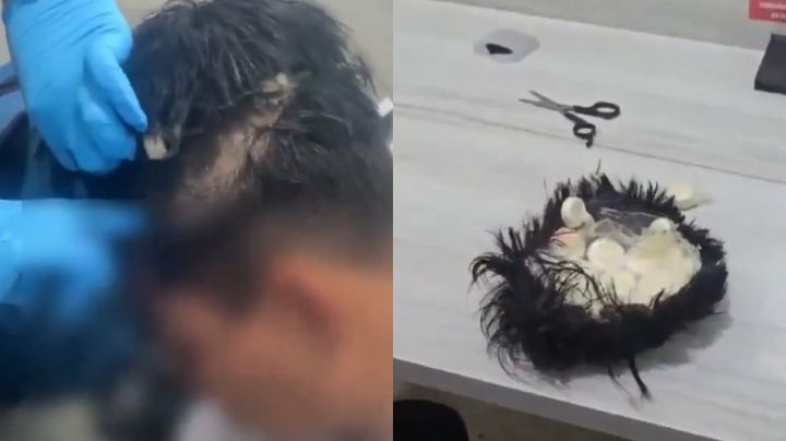 Detienen en Colombia a hombre con ‘narcopeluca’ donde guardaba cocaína