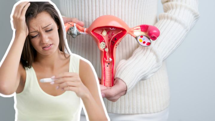 Endometriosis y fertilidad: ¿Es posible quedar embarazada con esta condición?