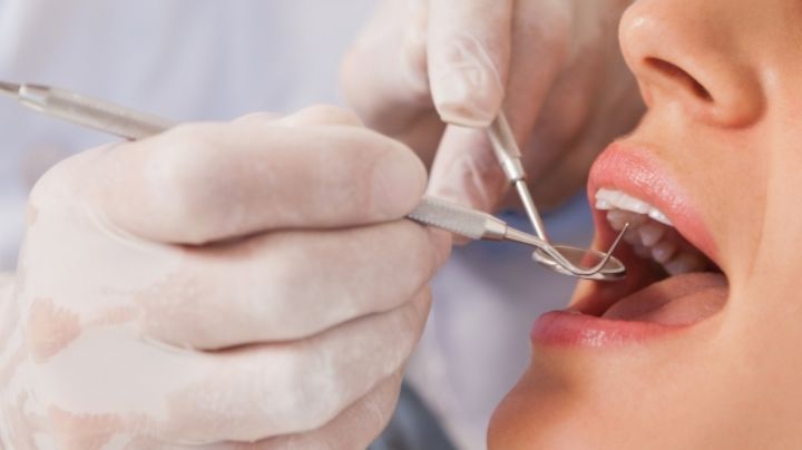 ¿Cada cuándo debo ir al dentista y cuánto dinero se tiene que ahorrar?