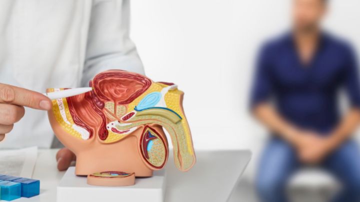 Día Mundial del Cáncer de Próstata: ¿A qué edad hacer los exámenes y cuánto cuestan?