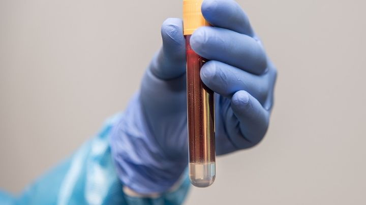 Salud rechaza pruebas de sangre para diagnosticar covid