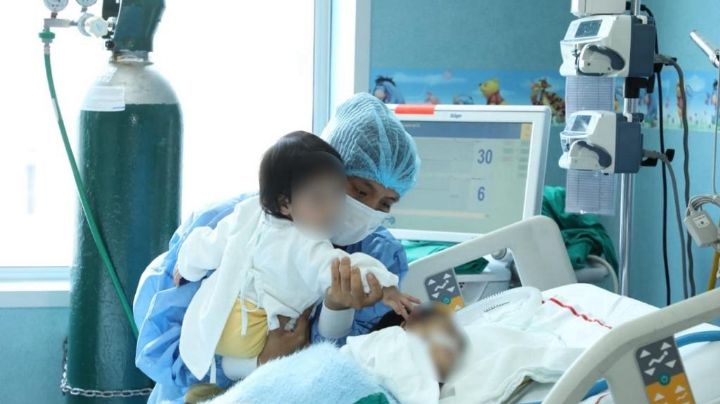 Siameses unidos por el vientre son operados con éxito en Lima, Perú