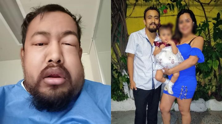 'Si no tengo pronto un riñón moriré', hombre pide ayuda a regios para sobrevivir