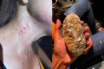 Agreden con pedrada a joven que circulaba en la Carretera Nacional