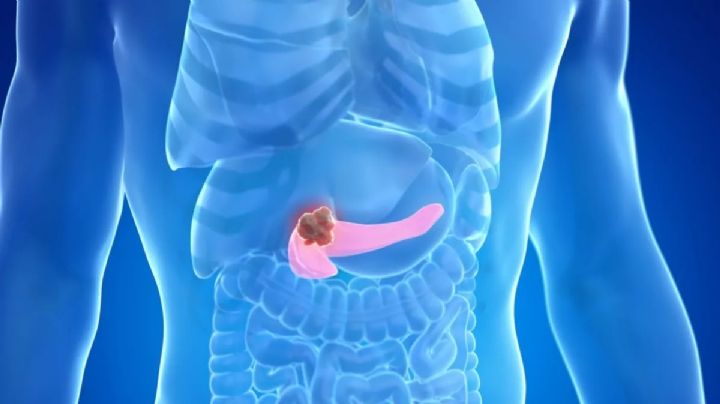 Cáncer de páncreas: Vacuna experimental de ARN muestra resultados prometedores