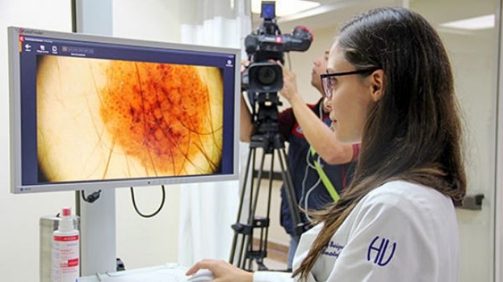 UANL realizará campaña para la detección y prevención de cáncer de piel en NL