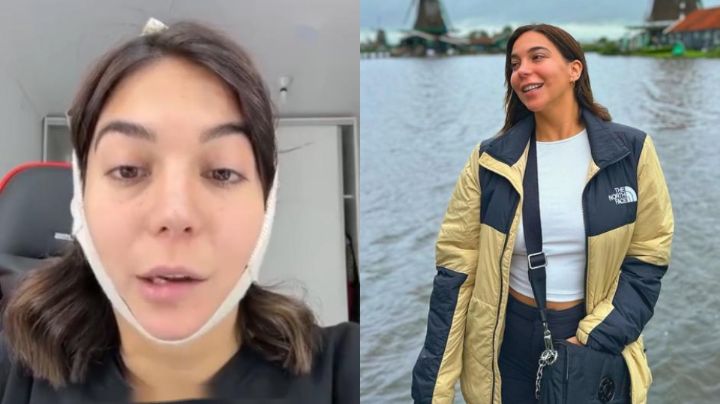 Influencer sufre parálisis facial tras someterse a una liposucción de papada