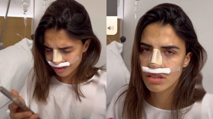 Video: Influencer rompe en llanto tras ver los resultados de su rinoplastia   