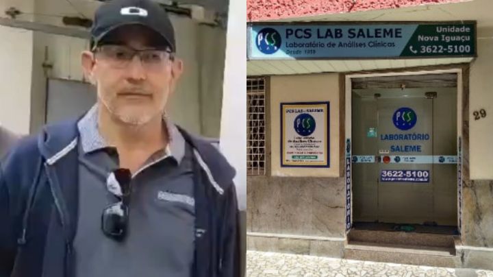 Seis pacientes dan positivo a VIH por trasplante de órganos infectados en Brasil