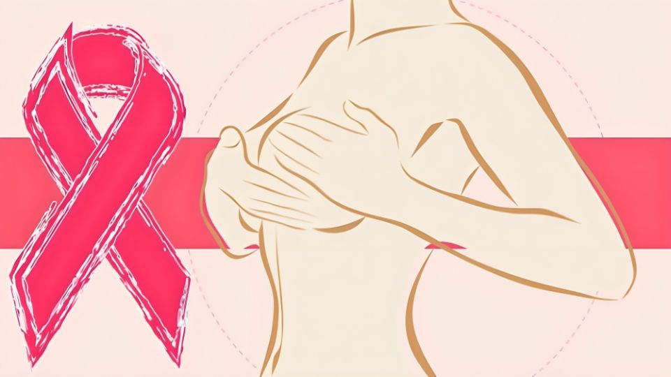 Apoyo psicológico para las personas de cáncer de mama.
