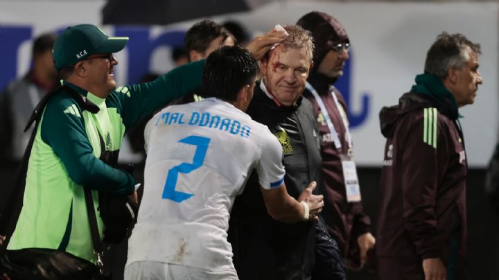 FMF se manifiesta tras agresión que descalabró a Aguirre; CONCACAF investiga