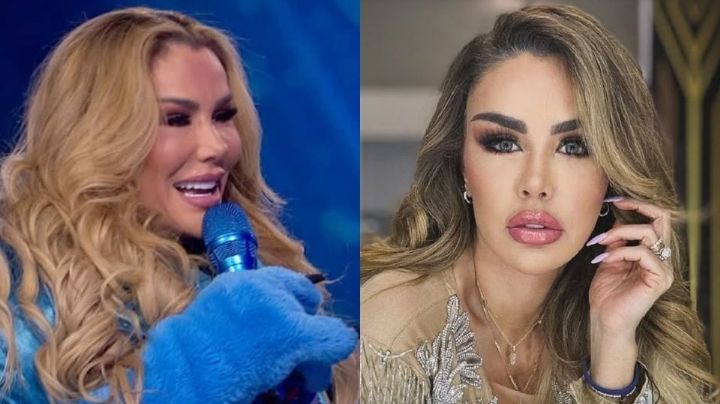 Ninel Conde se someterá a nueva cirugía tras criticas sobre su rostro