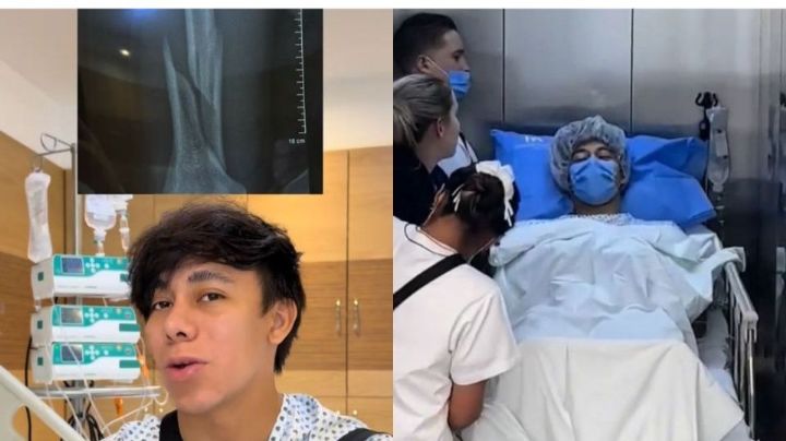 Influencer sufre fractura jugando a las 'vencidas'; podría perder la movilidad de su mano