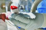 México confirma al menos 20 niños afectados por bacteria Klebsiella oxytoca