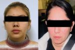 Mujeres duermen a hombre con clonazepam y le roban pertenecías en Apodaca