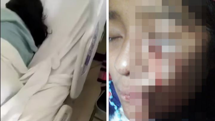 Bala perdida hiere a niña mientras dormía en Chiapas