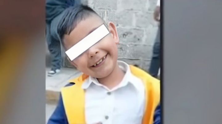 Niño pierde ojo tras ser agredido con un vidrio por un compañero en escuela de Hidalgo