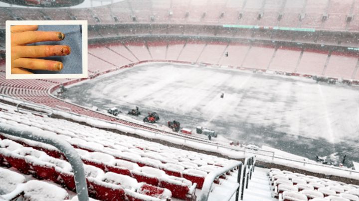 Fanáticos de los Chiefs requerirán amputación tras sufrir congelación en juego de playoffs