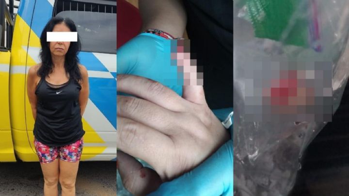 Revelan fotos de mujer que arrancó parte del dedo a otra en gym de Monterrey