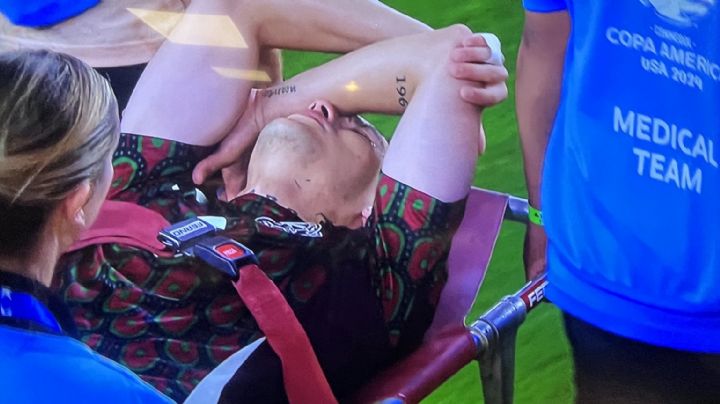 Rayados: Gerardo Arteaga salió lesionado en la Copa América