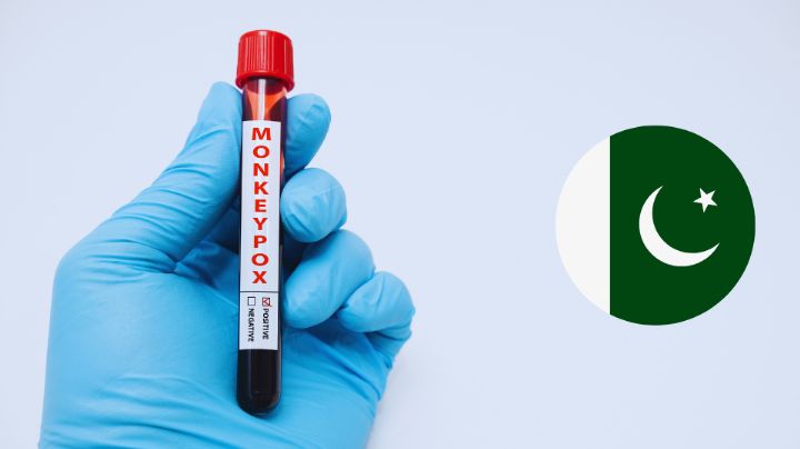 Pakistán confirma caso positivo de viruela del mono