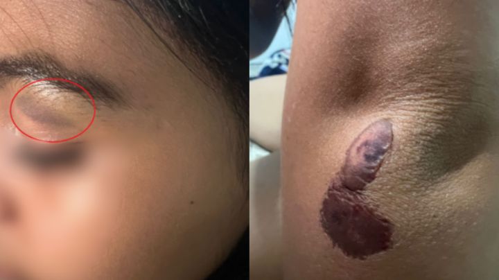 Madre denuncia injusticia hacia su hija golpeada y suspendida de la Preparatoria 16